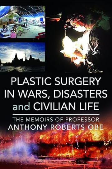 Historical illustration of early reconstructive surgery during wartime medical care